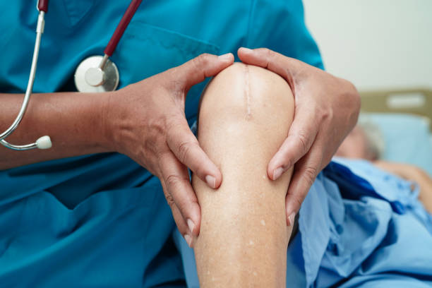 knee replacement surgery